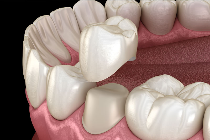 close up graphic of crown