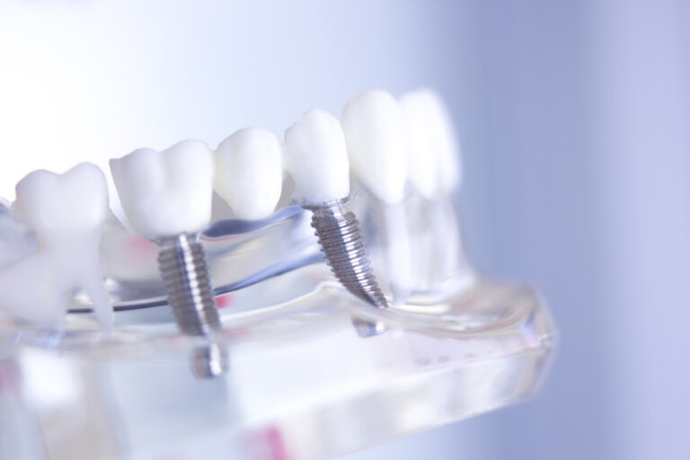 Consultation at a dental practice highlighting patient-focused care